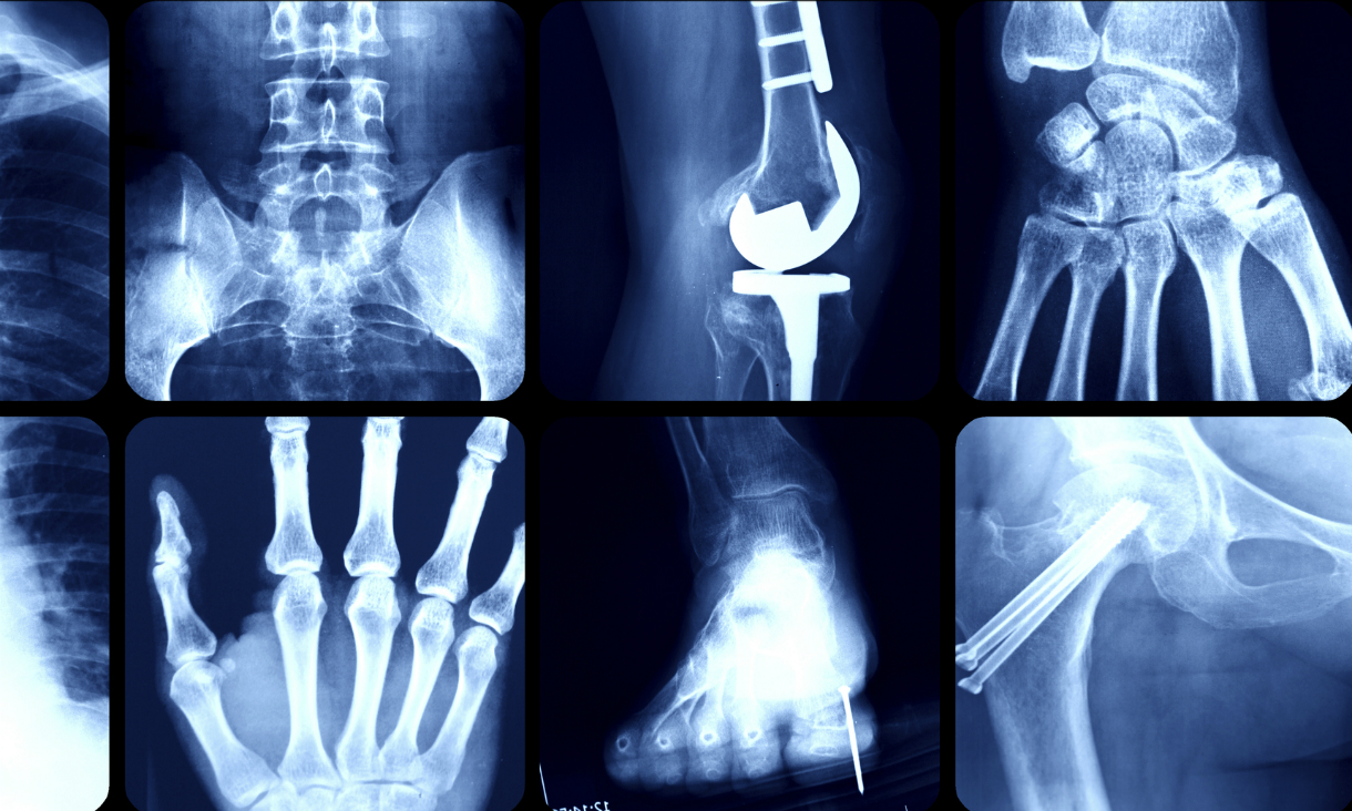 X-ray images.