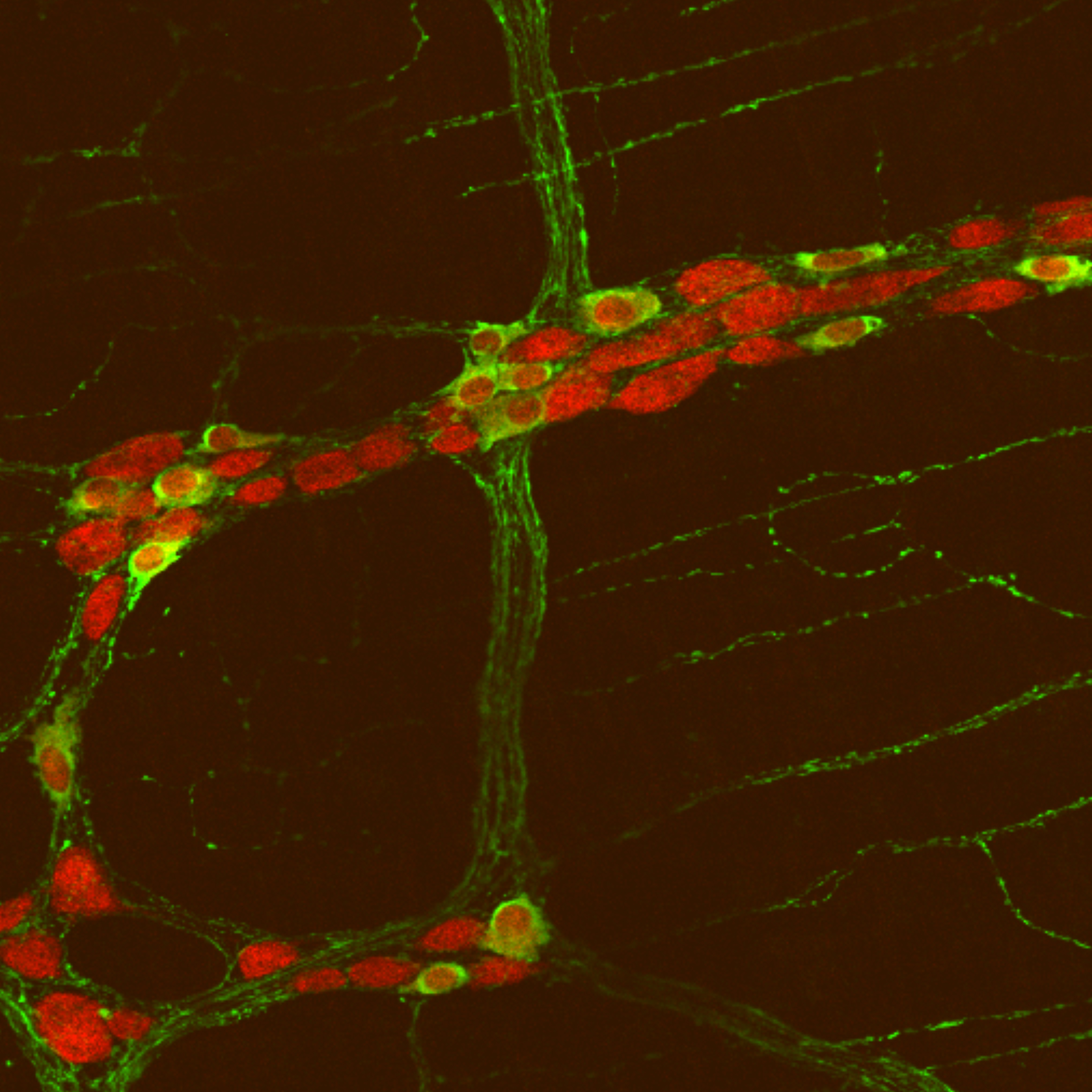 An image showing neurons in the gut of a mouse with the autism-related gene mutation. The study found mice with the mutation had more neurons in the small intestine.