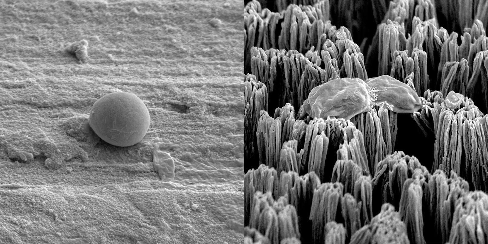 An intact Candida cell on polished titanium surface (left), and a ruptured Candida cell on the micro-spiked titanium surface (right).
