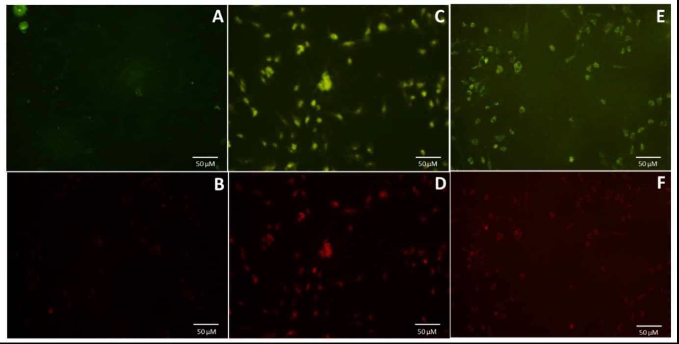 Six flourescent images showing cells