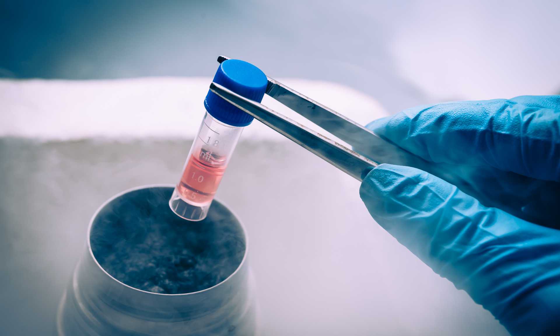 A Liquid Nitrogen bank containing suspension of stem cells. Cell culture for the biomedical diagnostic
