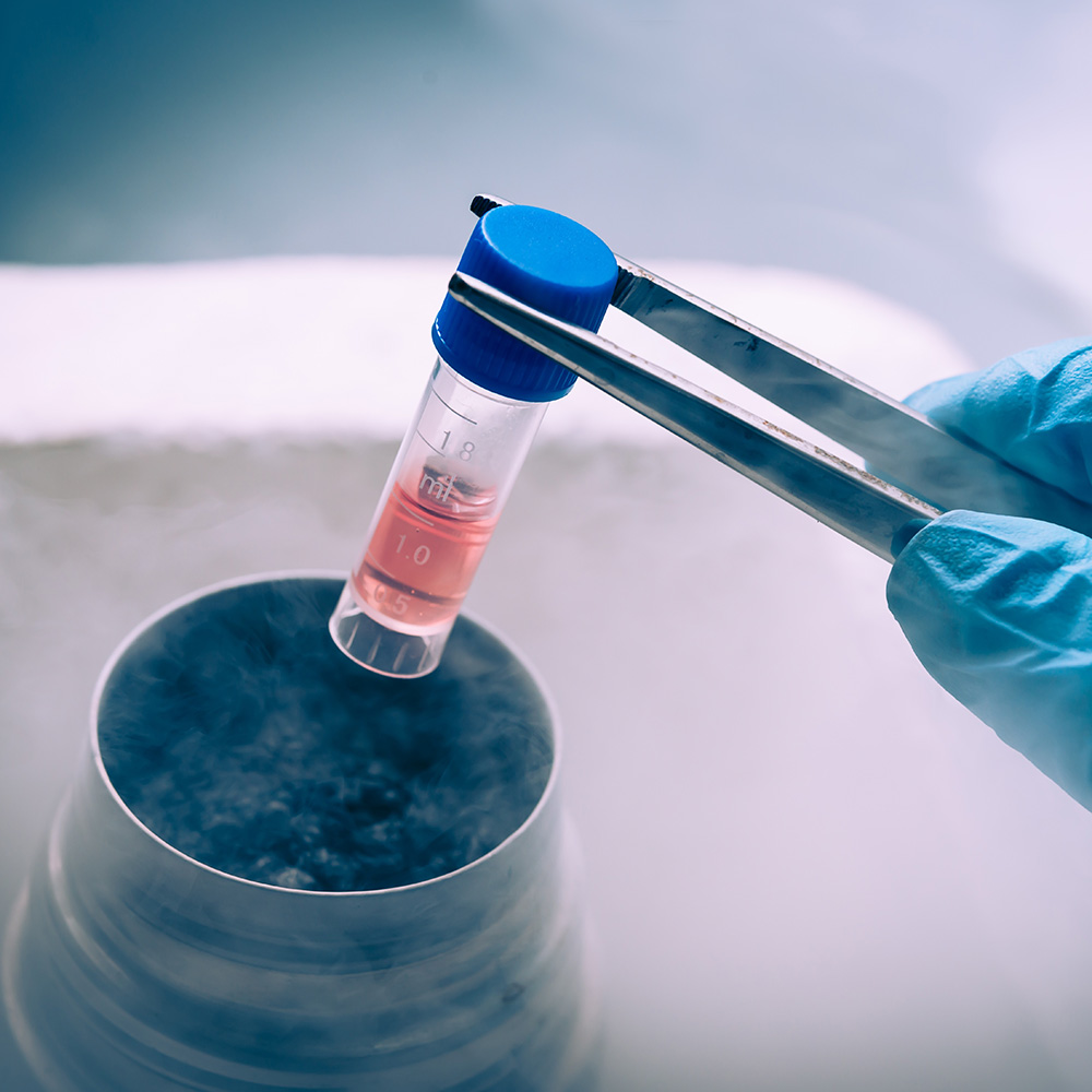 A Liquid Nitrogen bank containing suspension of stem cells. Cell culture for the biomedical diagnostic