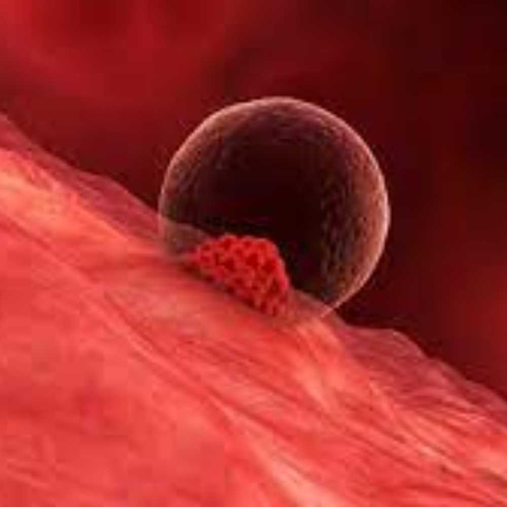 Embryo implantation
