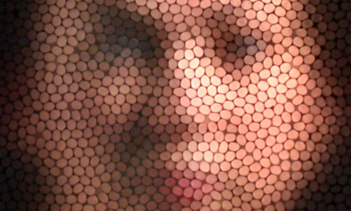 “bee eye” camera