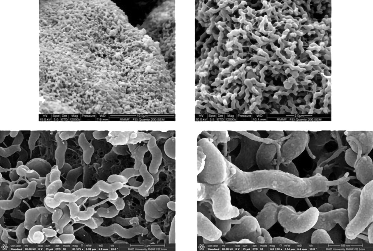 Scanning electron micrographs of a colony of Campylobacter hepaticus. 
