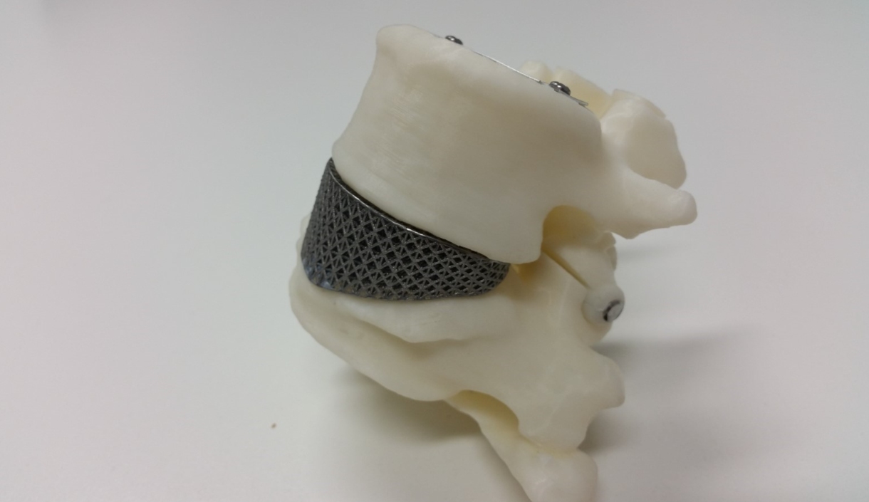 Litter Trackers project