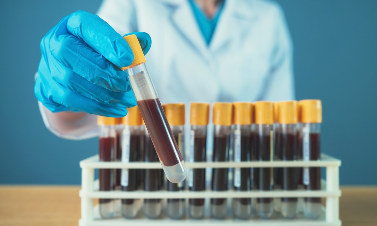 news-blood-test-1220_x_732.jpg