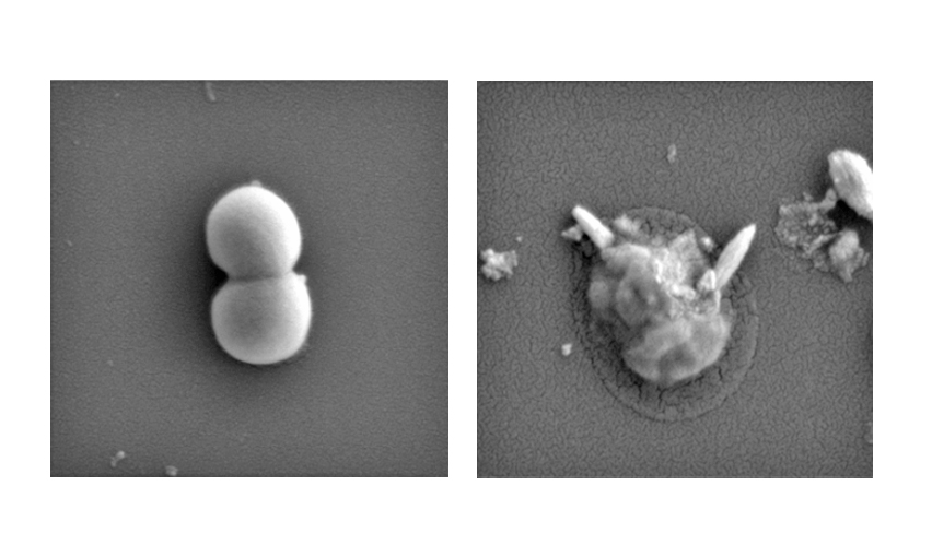 Golden Staph bacteria before (left) and after (right) exposure to the magnetic liquid metal nanoparticles. In the images, magnified 70,000 times, sharp pieces of liquid metal particle can be seen physically disrupting the bacteria after treatment.