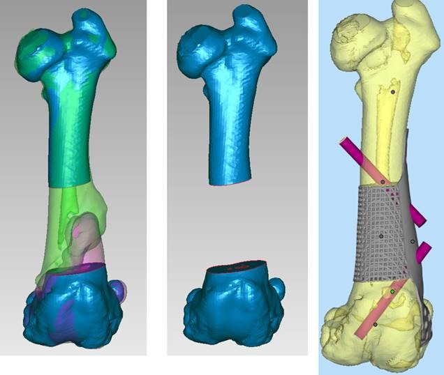 Model of the titanium bone plate, supplied by Jayne McGhie