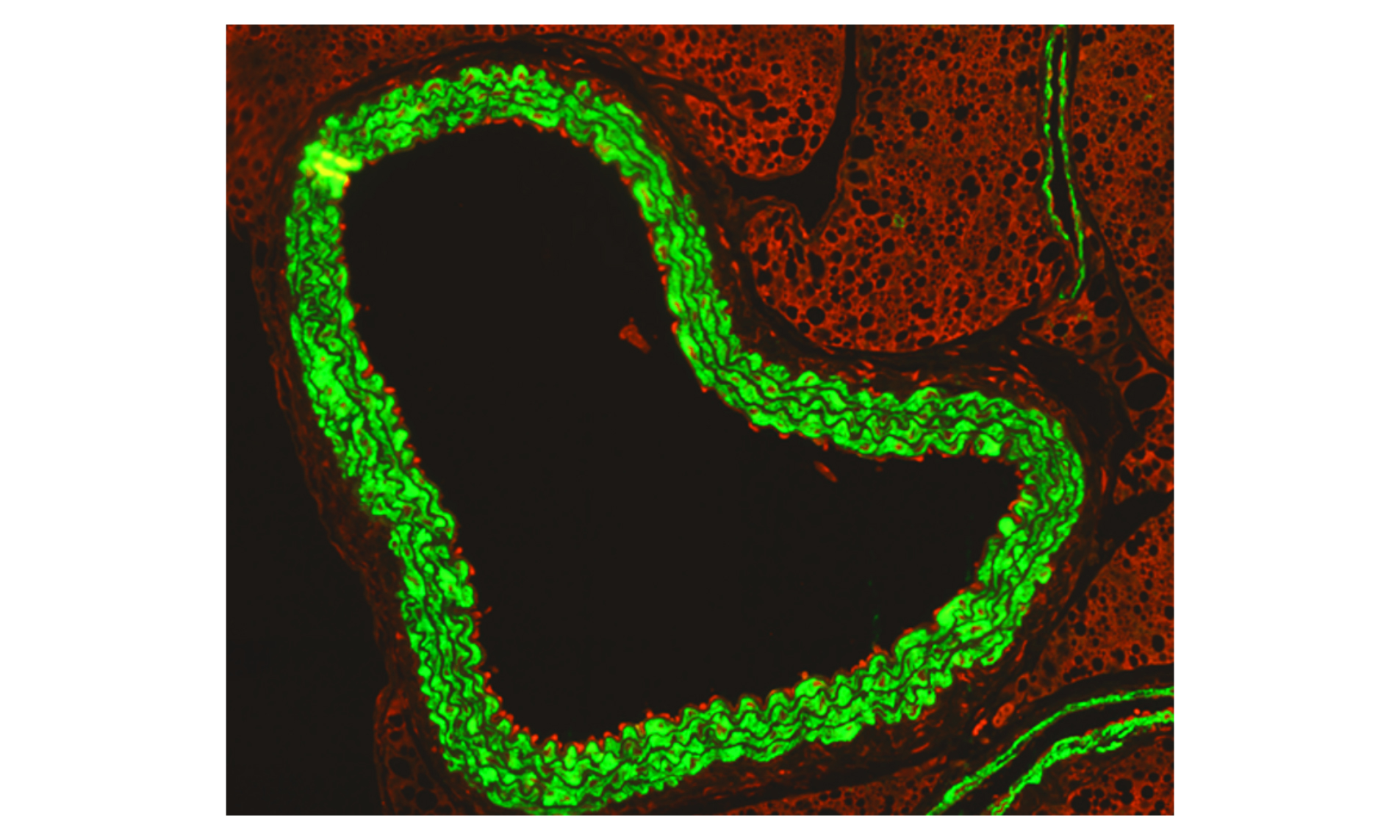 An immunofluorescence microscopy image shows how activated immune cells ‘stick’ to the inside of the aorta during flu infection in pregnancy. 