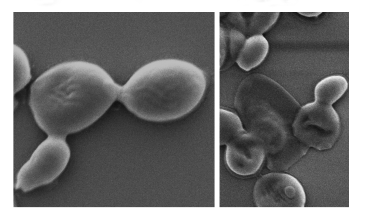 Candida auris fungus before exposure to ultrathin layers of black phosphorous (left) and after (right).  