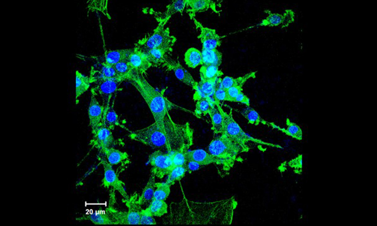 Microscope image of neural cells.