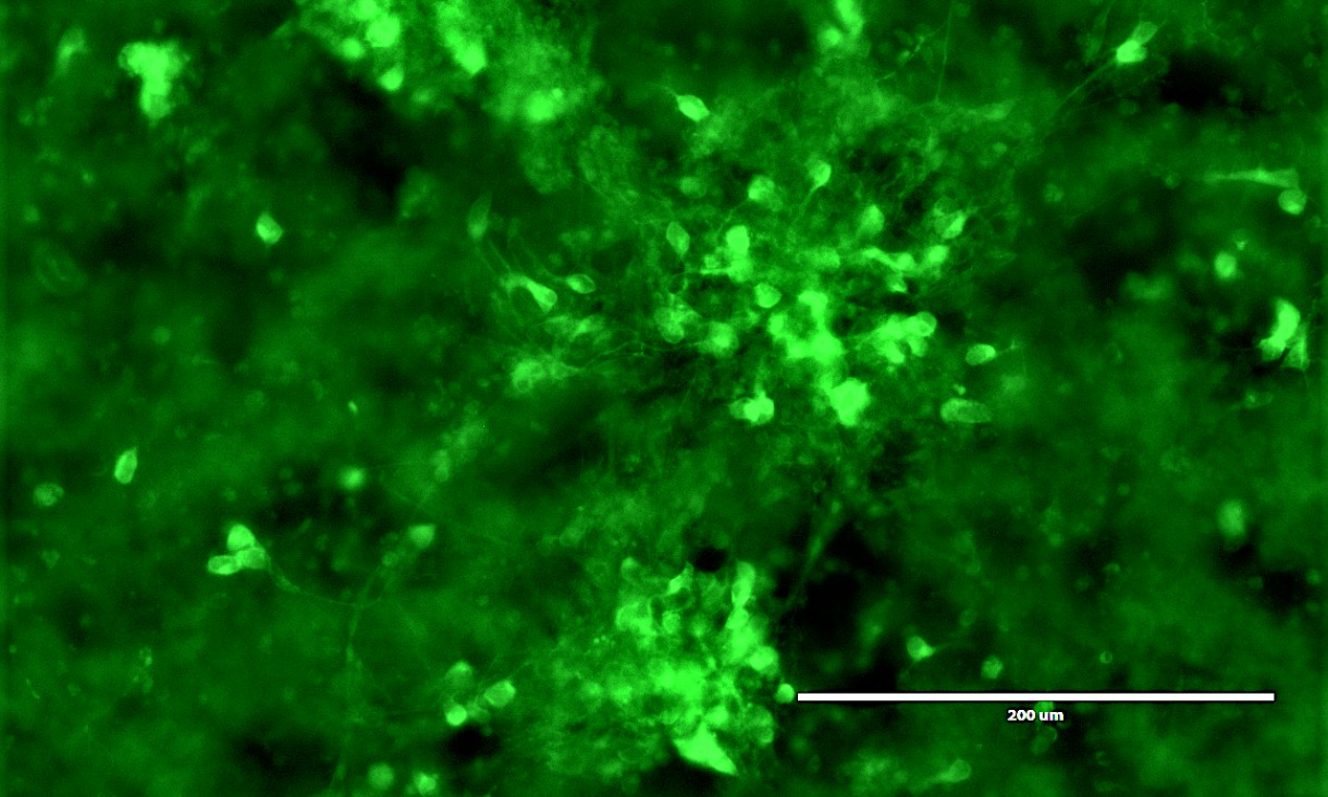 Neural cells in a 3D block