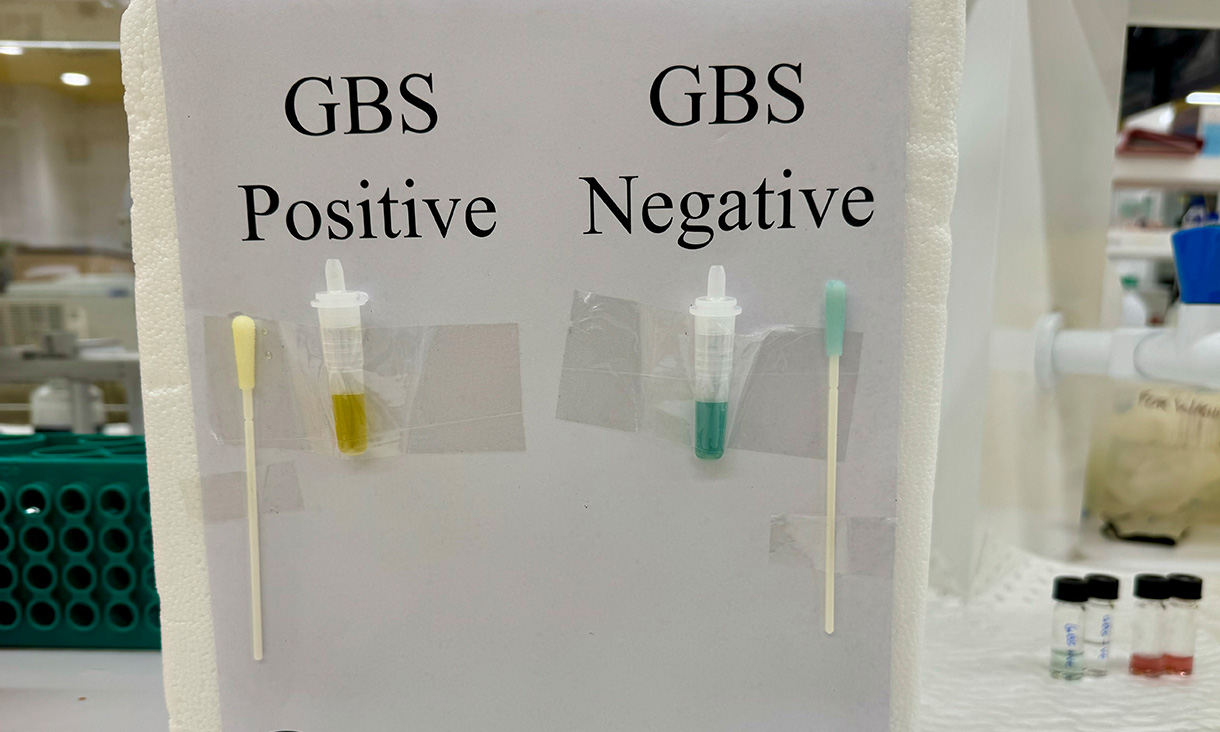 This new sensor technology would cut the testing time down to 15 minutes.  Credit: Will Wright, RMIT University