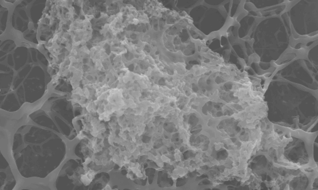 The antibacterial surface magnified 4,000 times under scanning electron microscope, showing the topographical feature of the coacervate resilin mimetic coating on the base scaffold substrate.