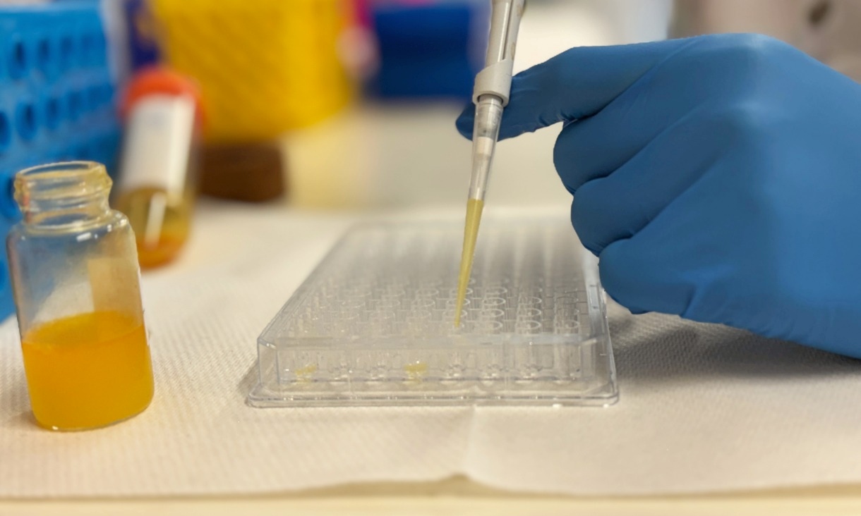 A pipette dispensing an orange liquid into a transparent test plate.