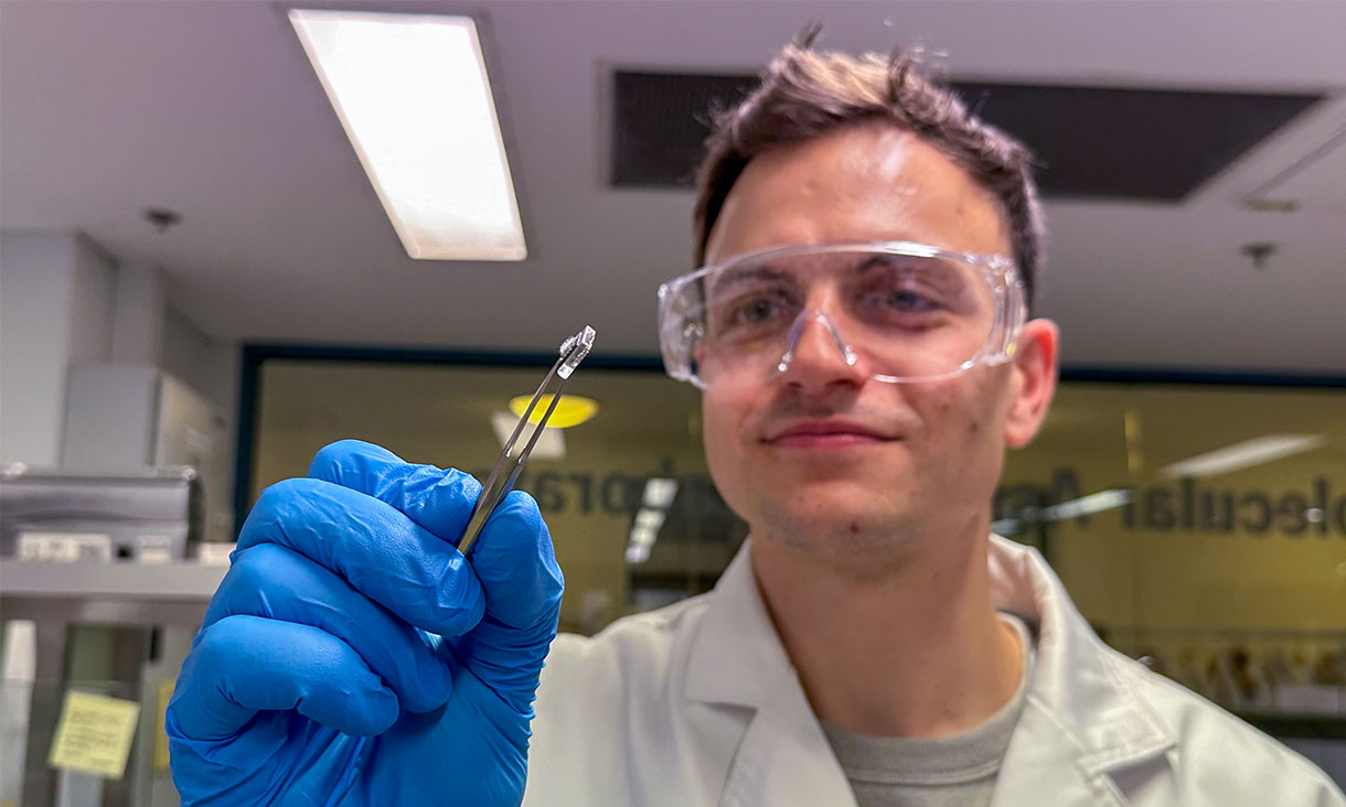 Dr Brendan Dyett holding a vaccine patch. 