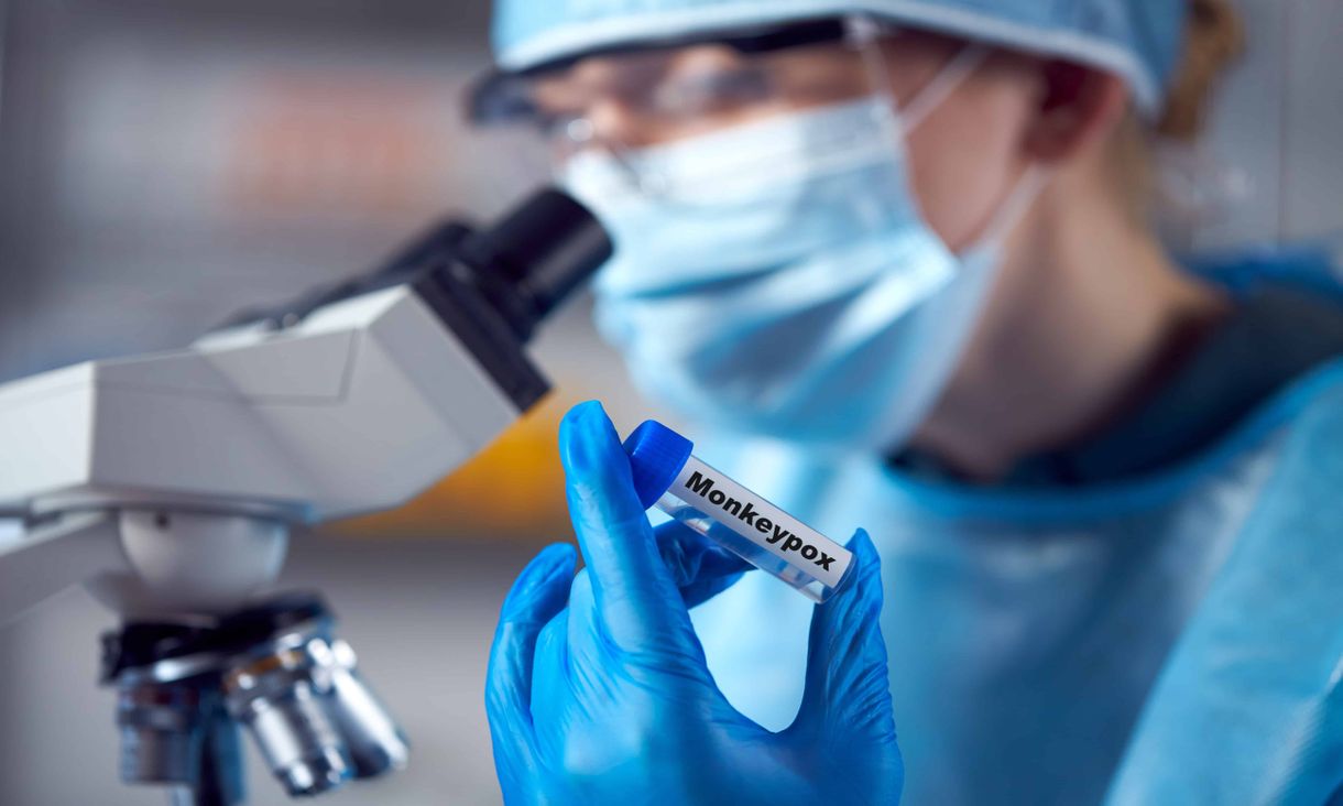 no-monkeypox-is-not-covid-vaccine-induced-shingles-in-people-with-hiv