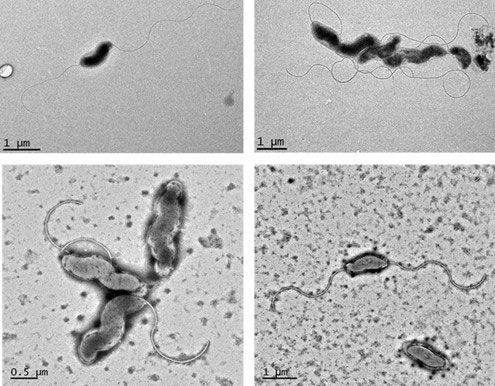 Transmission electron micrographs of Campylobacter hepaticus. 