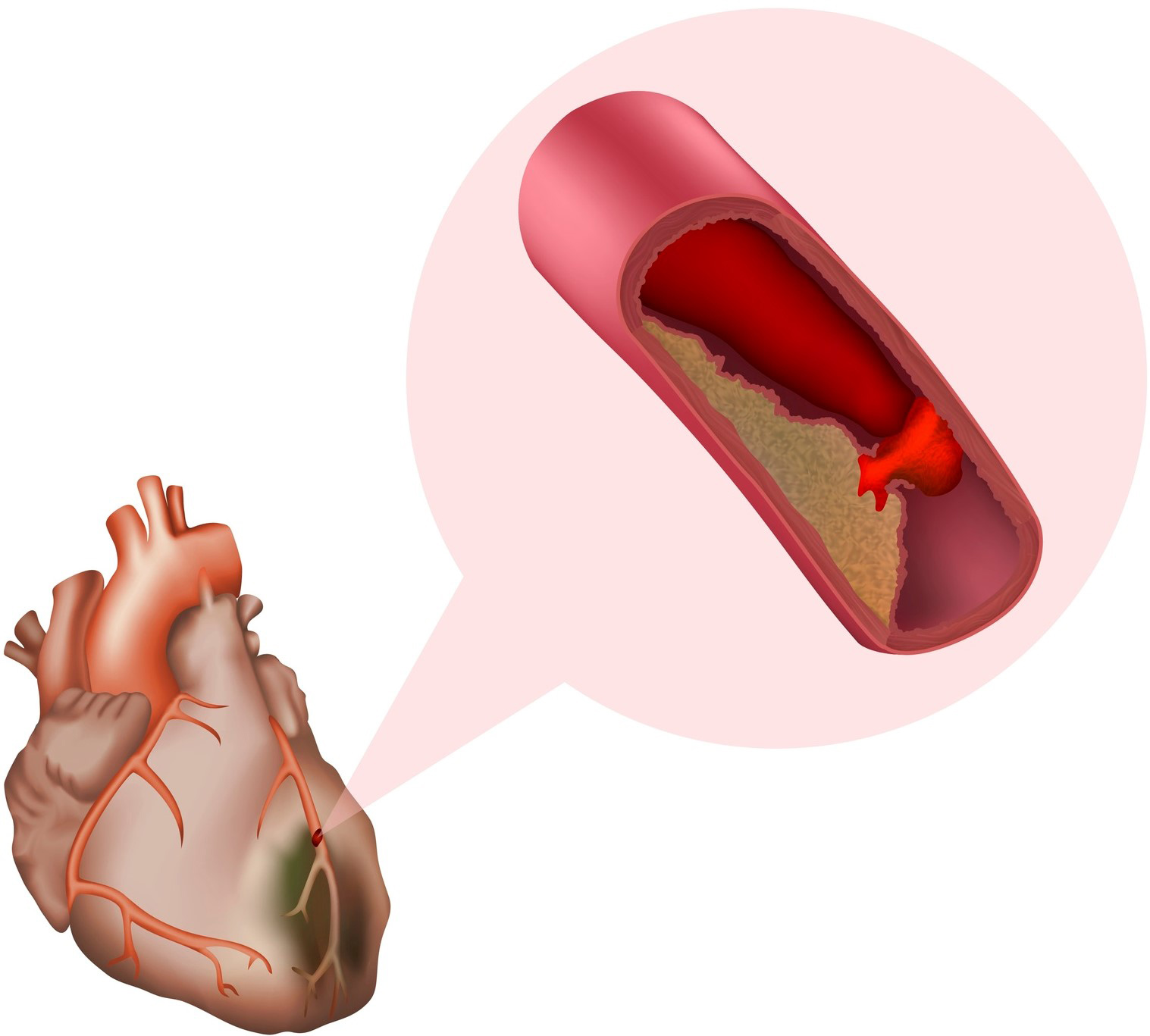 An image of a heart with a speech bubble showing a close-up of a device
