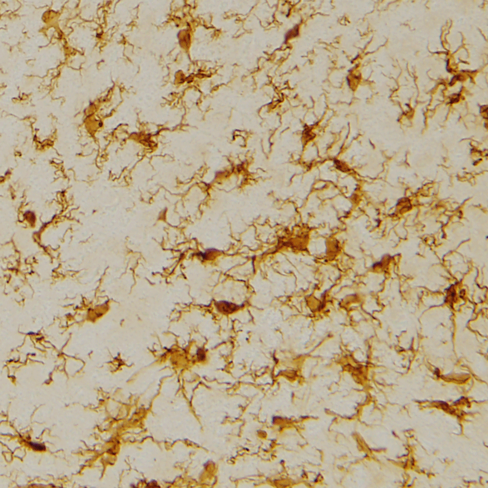 web-microglia-brain-inflammation.png