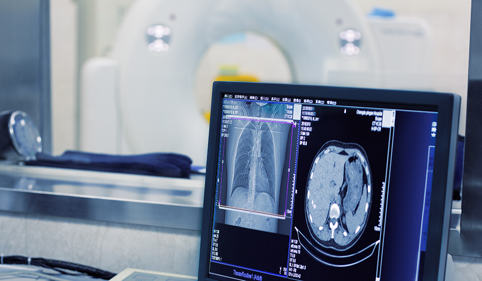 Computer monitor displaying medical imaging software representation of X-ray