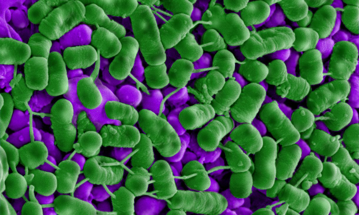 Microscope image of listeria bacteria dying after exposure to  Plantacyclin B21AG.