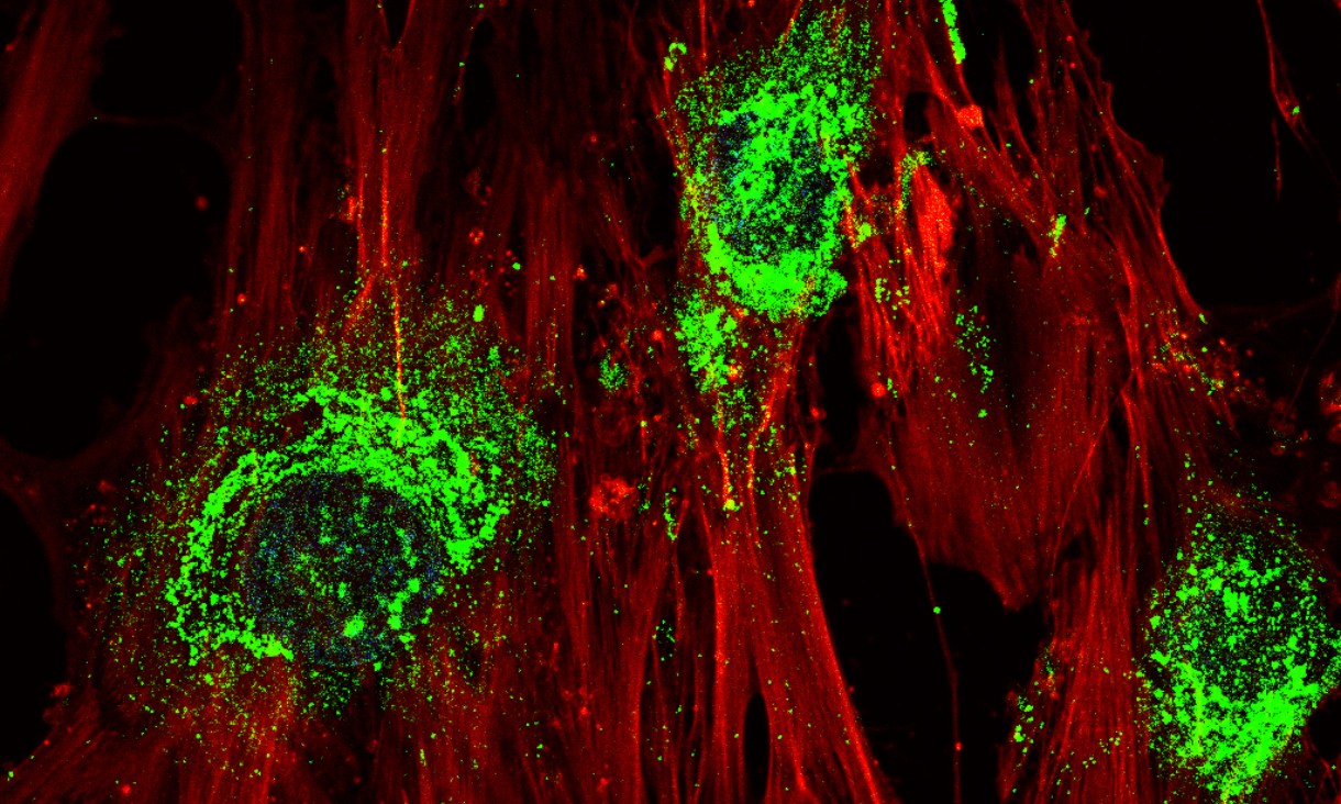 Magnified image showing adult stem cells in the process of turning into bone cells after treatment with high-frequency sound waves. Green colouring shows the presence of collagen, which the cells produce as they become bone cells. Magnification: 60X
