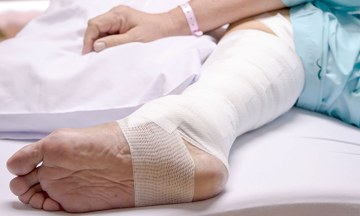 Nearly half a million Australians live with chronic wounds, which greatly affect their quality of life and cost the nation’s health system around $3 billion each year. Credit: Adobe Stock