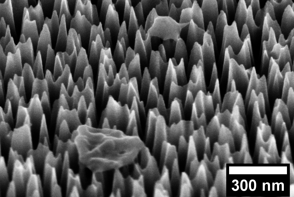 A virus on the nano spiked silicon surface, magnified 65,000 times. After six hours it has been completely destroyed. Credit: RMIT.