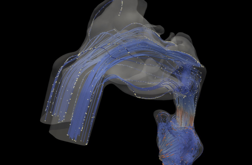 Figure 1: A CFD model of the human respiratory system during inhalation.Blue lines indicate the flow streamline and the white cones are indication of the flow direction along the upper airway.
