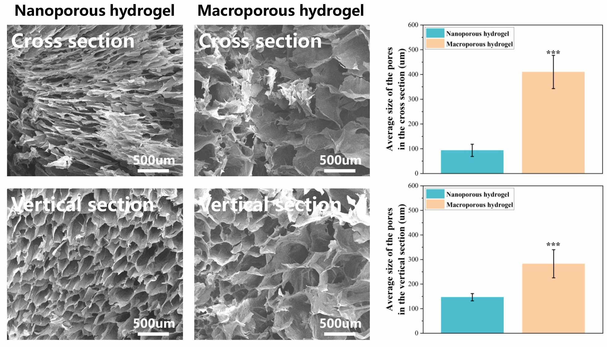Figure 2 Injectable hydrogel with macroporous structure